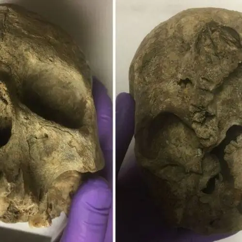 Carbon Dating Just Revealed The 'Oldest' British Skull To Be Much Younger — And Possibly A Hoax