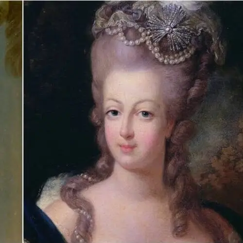 Can Marie Antoinette Syndrome Really Turn Your Hair White From Fright?