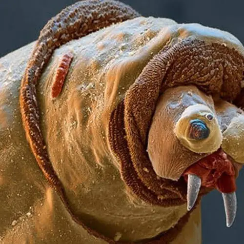 44 Mind-Blowing Pictures Of Ordinary Creatures Under An Electron Microscope