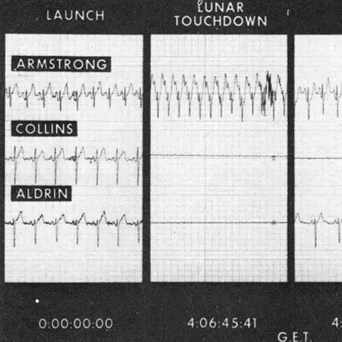 Neil Armstrong's Heart Rate During The Apollo 11 Mission