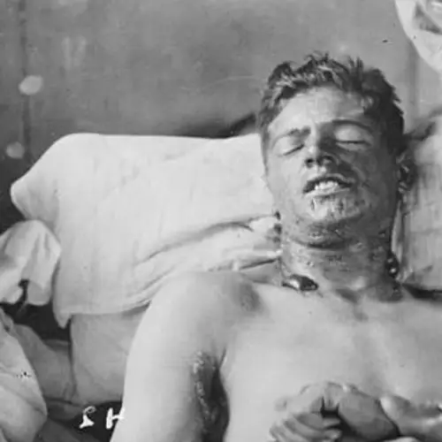 The 6 Most Evil Human Experiments Perpetrated By The U.S. Government