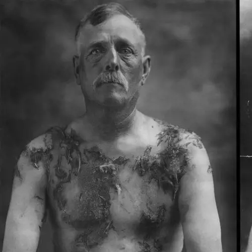 What Anti-Immigrant Hysteria Looked Like 100 Years Ago [24 PHOTOS]