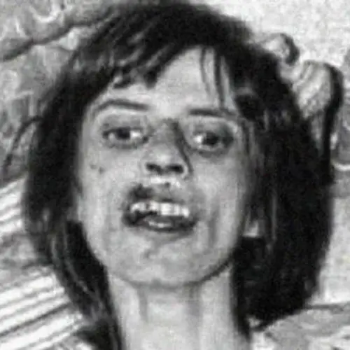 Anneliese Michel And The Shocking Images From The Exorcism Of The Real Emily Rose