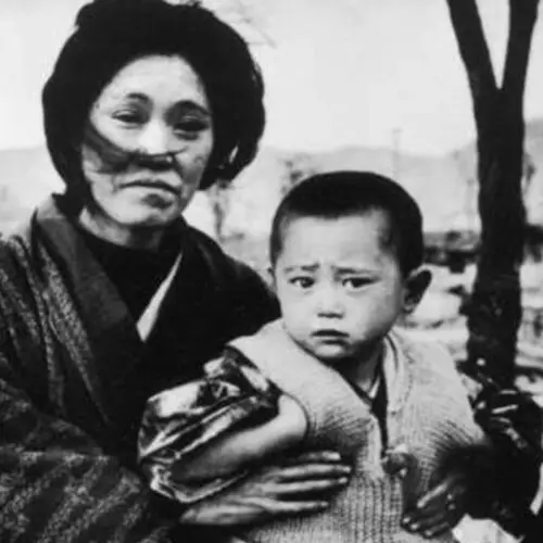 Devastating Photos Of Hiroshima Before And After The Atomic Bombing That Changed History Forever