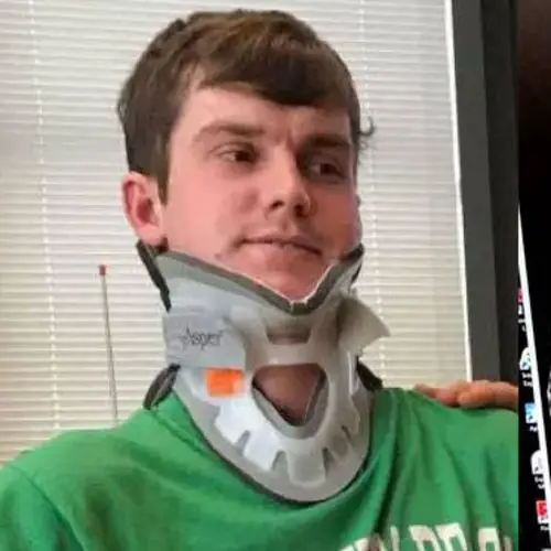 Internal Decapitation: What It Is And How One Man Survived