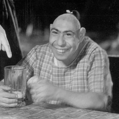The Sad Story Of Schlitzie, The Sideshow "Pinhead" Made Famous By The Movie 'Freaks'