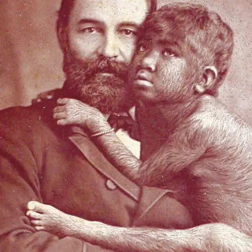 44 Vintage Photos Of Sideshow "Freaks" That Will Leave You Unsettled