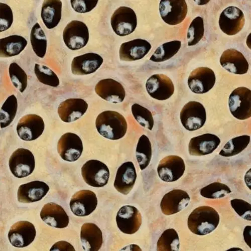 What Is Trypophobia? Inside A Surprisingly Common And Misunderstood Fear