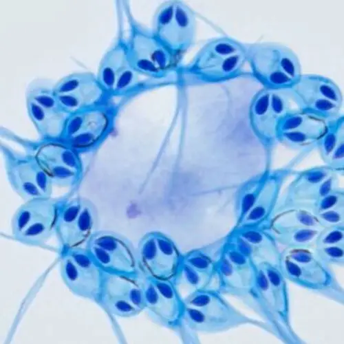 Scientists Discovered A Non-Oxygen Breathing Animal Species On Earth For The First Time