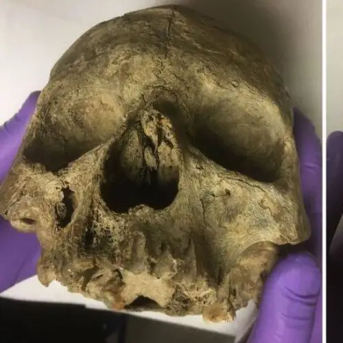 Carbon Dating Just Revealed The 'Oldest' British Skull To Be Much Younger — And Possibly A Hoax