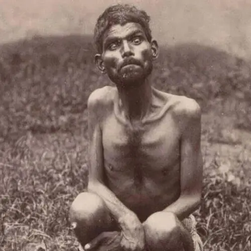 From The 'Real-Life Mowgli' To The 'Human Pet,' Learn The Bizarre Stories Of 9 Feral Children From History