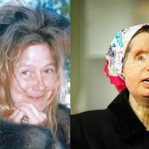 How Charla Nash Survived One Of The Most Horrifying Animal Attacks In History