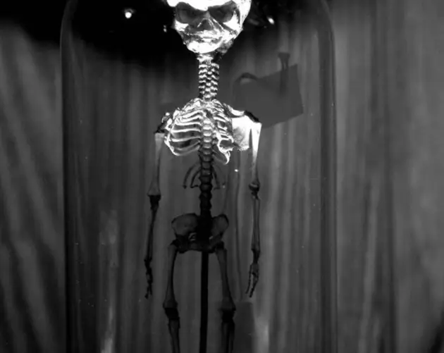 Skeletal Fetus Remains