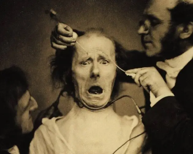 Scariest Picture Ever Taken Duchenne De Boulogne