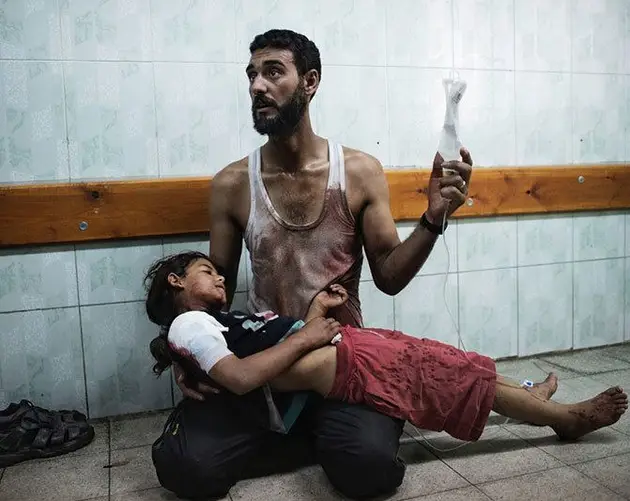 Child Struck by Bombs