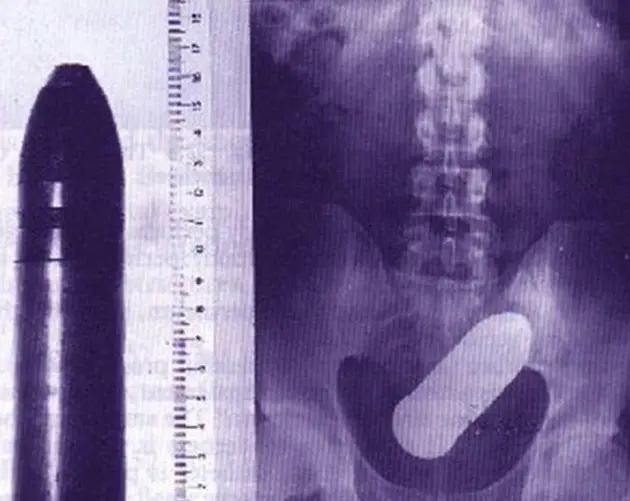 Funny X Rays Live Round