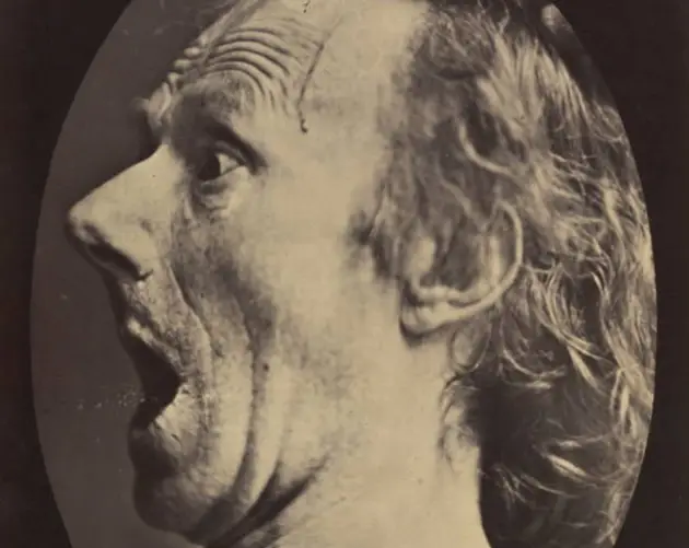 Mouth Open Profile