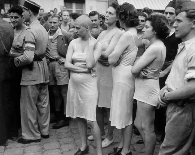 Women Bald