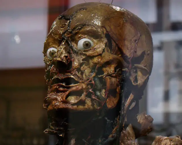 Flayed Man