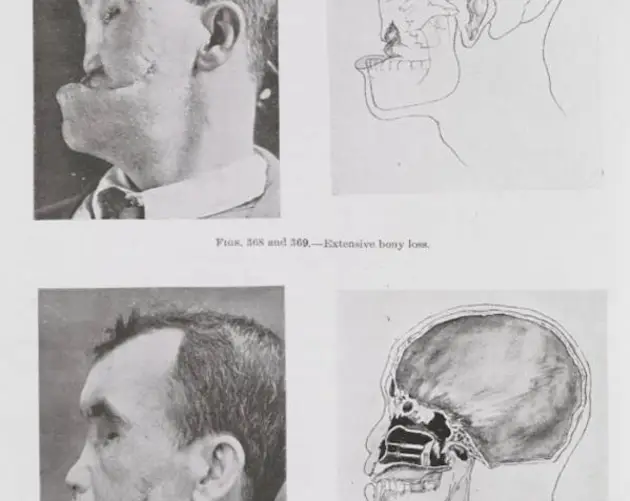 Harold Gillies's Book