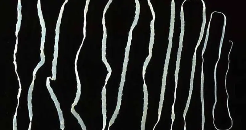 Seven Of The Dumbest Diet Trends In History