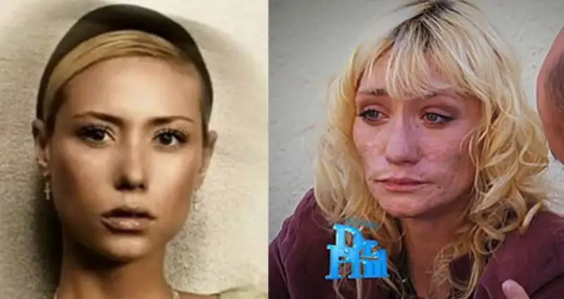 This Is What The Meth Epidemic In America Looks Like