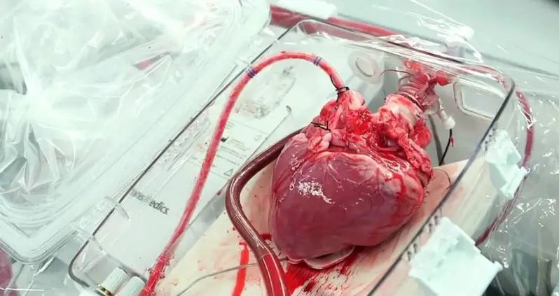 Can Donor Hearts Transplant Memories?