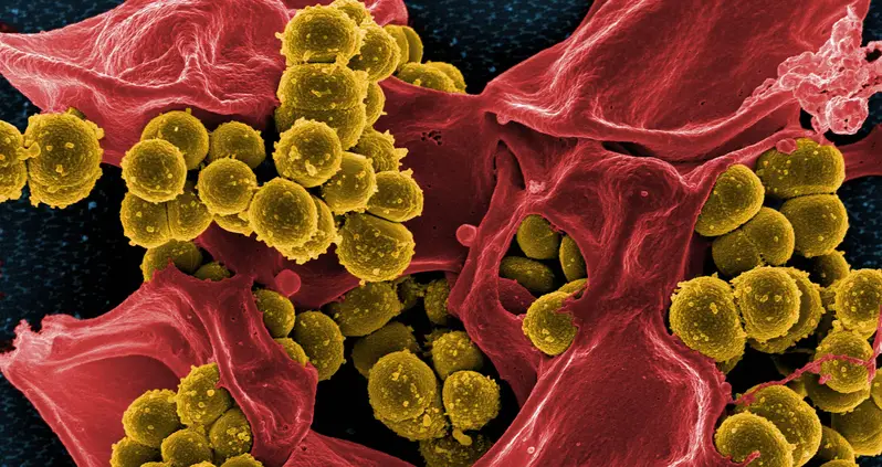 What You Need To Know About “Superbugs”