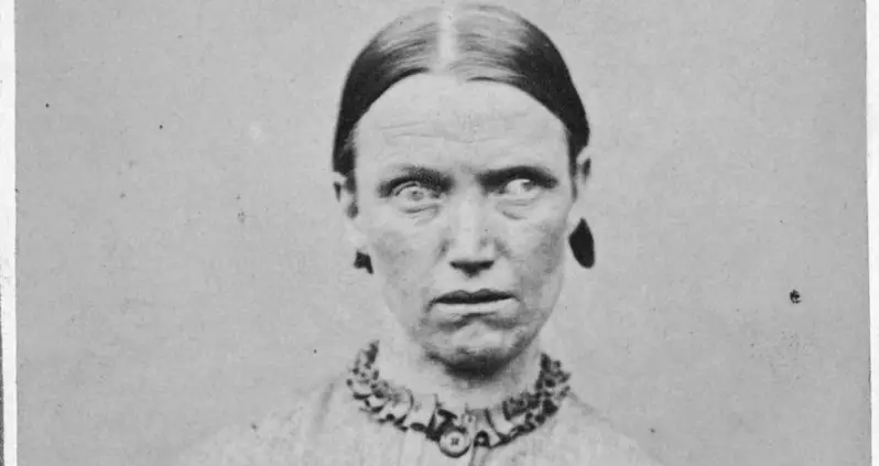 37 Haunting Portraits Of 19th Century Mental Asylum Patients