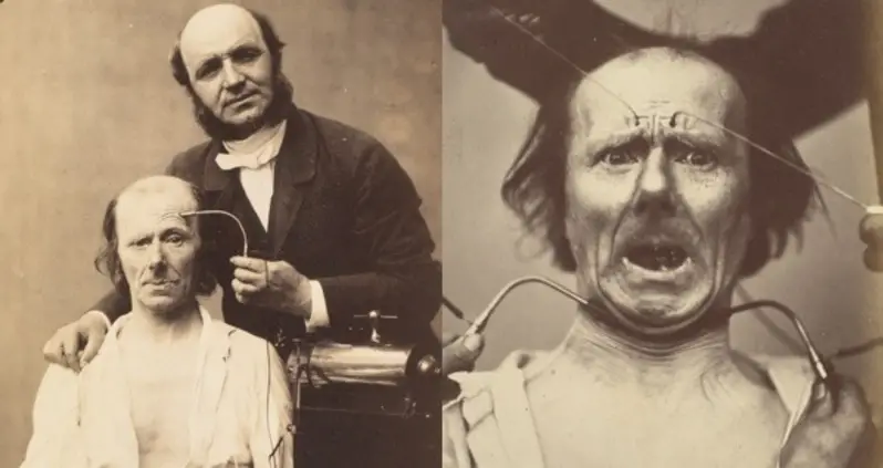 Haunting Photos From One Of The Most Horrific Looking Human Experiments Ever Conducted