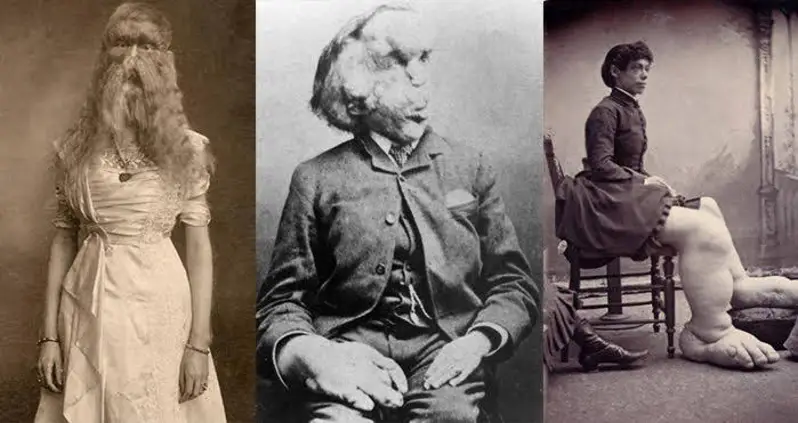 25 Photos Of “Freak Shows” That Are Thankfully A Thing Of The Past