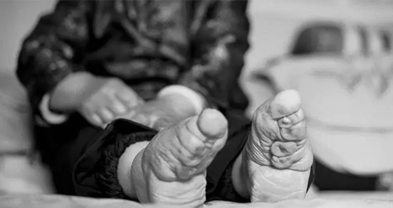 Inside The Disturbing Practice Of Chinese Foot Binding