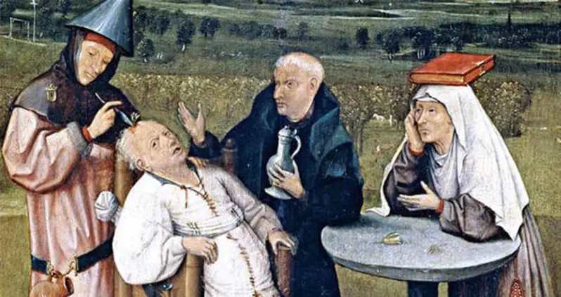 Trepanation Was The Bizarre Cure-All That Exposed Your Brain