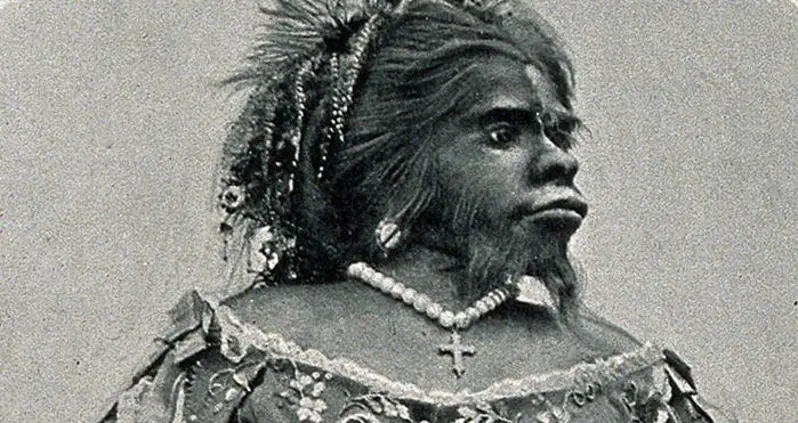 The Story Of Julia Pastrana, The ‘Ape Woman’ Sideshow Performer