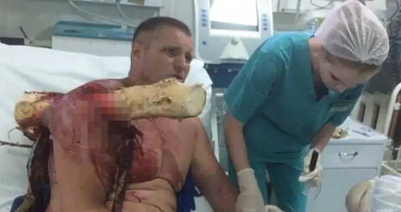 World’s Biggest Badass Dismisses Tree Branch Stuck In Shoulder As Mere “Splinter”