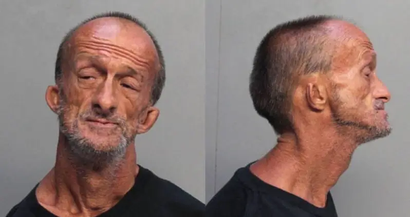 Armless Florida Man Arrested For Stabbing Tourist With Scissors