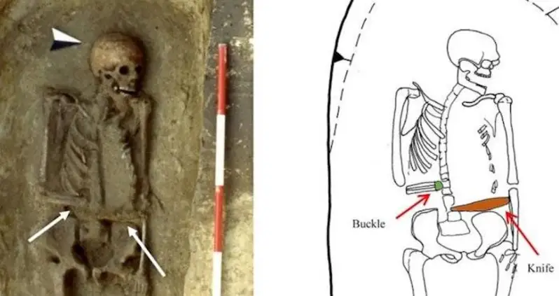 This Medieval Warrior Had His Hand Amputated, Then Replaced It With A Prosthetic Knife