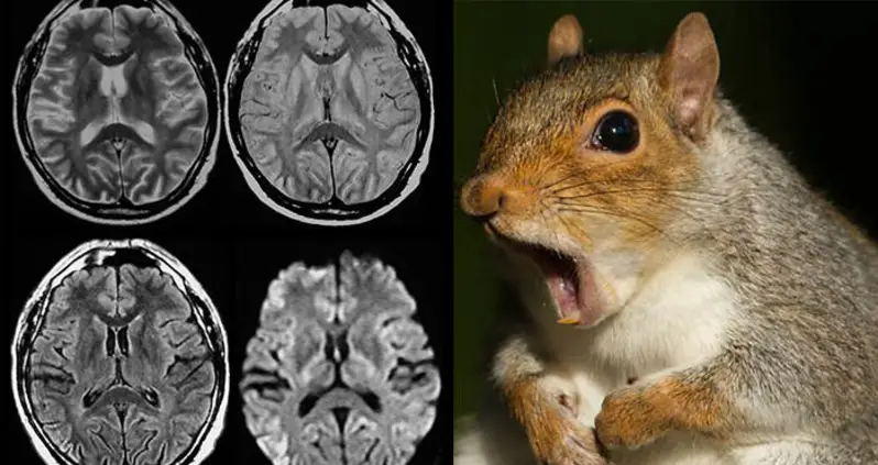 New York Man Dies After Contracting Mad-Cow-Like Disease From Eating Squirrel Brains