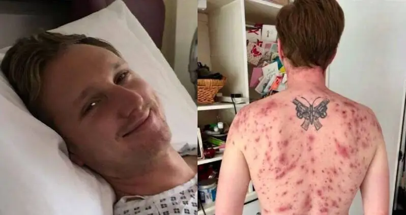 Parasitic Worm Crawls Up Man’s Penis, Lays Eggs, And Then Nearly Kills Him