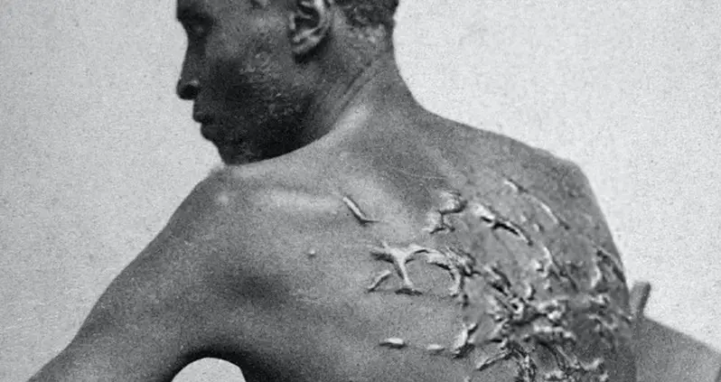 ‘Whipped Peter’ And The Photo That Exposed Slavery’s Horrors