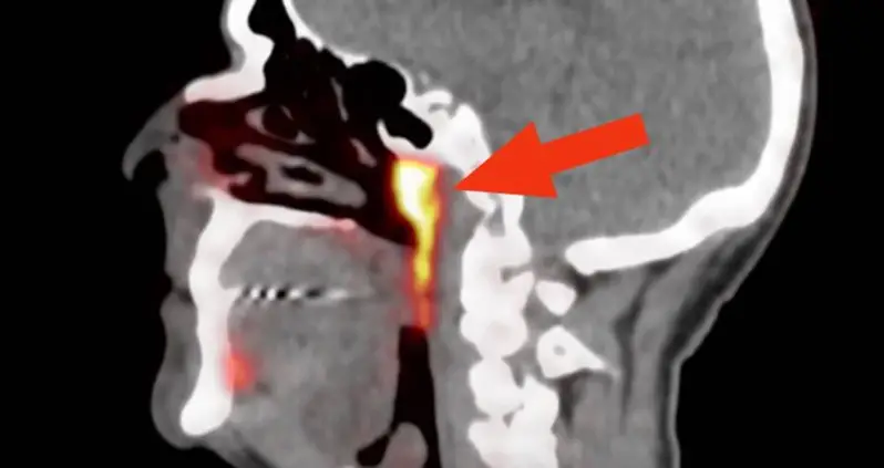 Cancer Researchers Accidentally Find Secret Organ Hidden Inside The Human Head