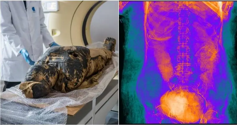 2,000-Year-Old Egyptian Mummy Turns Out To Be A Pregnant Woman In World First