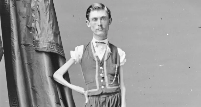 Isaac Sprague Found Sideshow Fame As The ‘Living Skeleton’ — But His Offstage Story Was Tragic