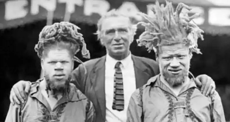 9 Unbelievable Stories Of Sideshow Performers Made Famous In 19th- And 20-Century ‘Freak Shows’