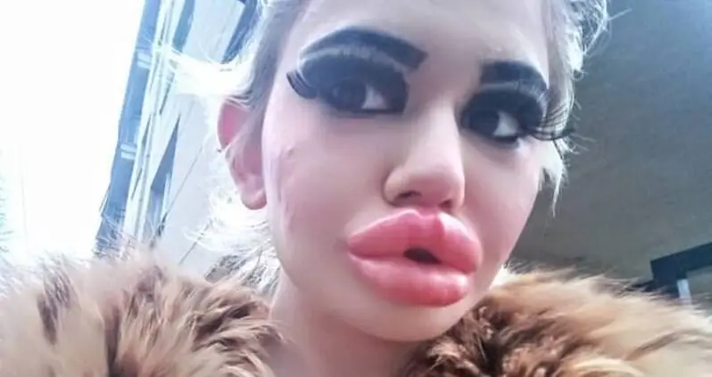 Meet Andrea Ivanova, The 24-Year-Old Bulgarian Woman With The ‘Biggest Lips In The World’