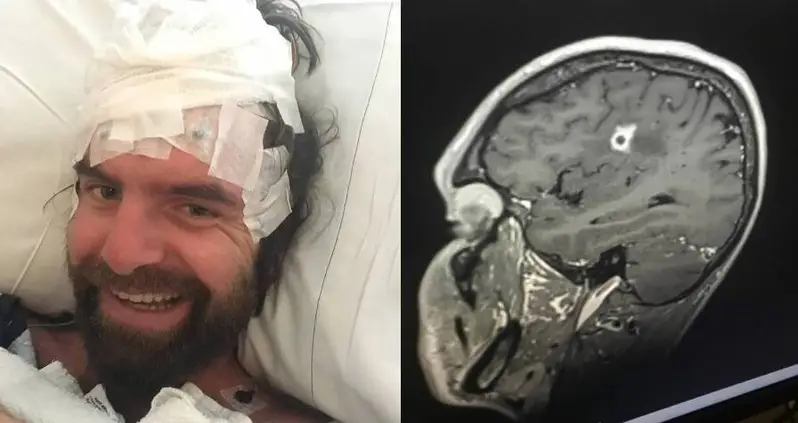 Doctors Discover Rare ‘Black Mold’ Growing In Rhode Island Man’s Brain