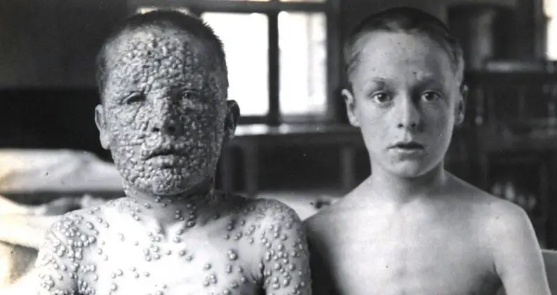 27 Photos That Illustrate The Devastating History Of Smallpox