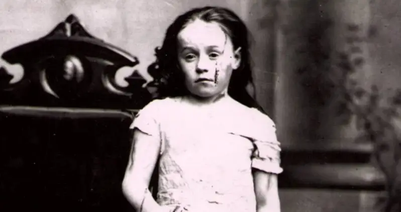 Mary Ellen Wilson And The 19th-Century Child Abuse Case That Changed History