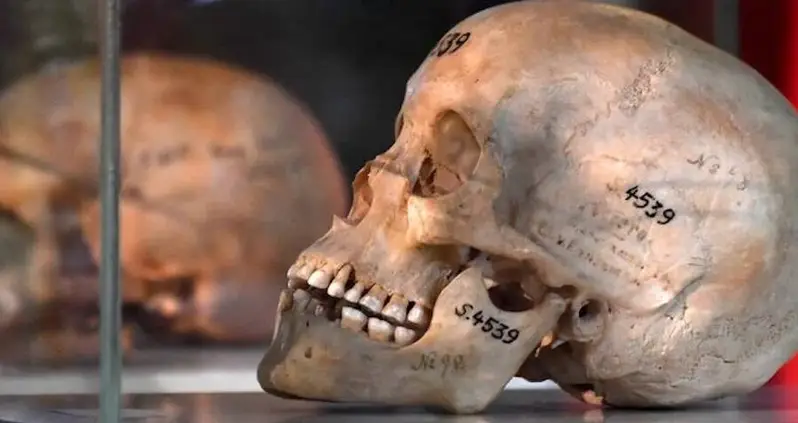 Belgian Auction House Cancels Sale Of Human Skulls From The Congo Following Public Outcry