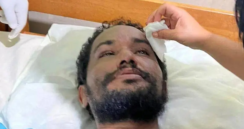 Bolivian Man Survives In The Amazon Rainforest For A Month By Eating Worms And Drinking His Own Urine